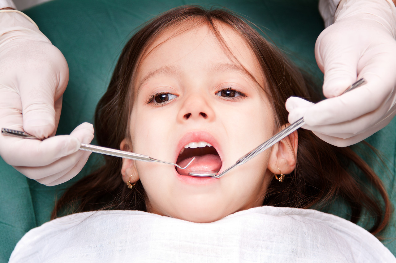 如何預防孩子出現牙齒擁擠