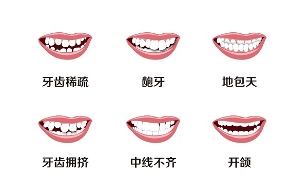 30歲以上年紀還能做箍牙嗎