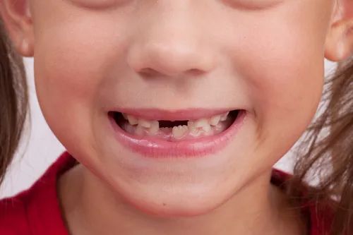 深圳牙醫解析孩子乳牙早失有什麼危害