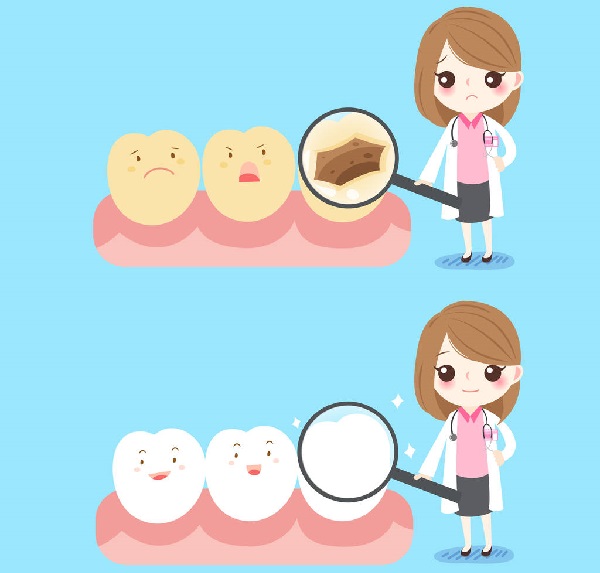 補牙必看|補牙的具體流程及步驟過程