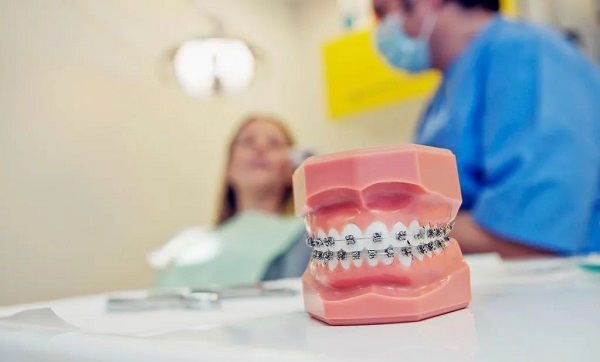 矯牙為什麼需要拔牙?兒童和成人箍牙有區別?