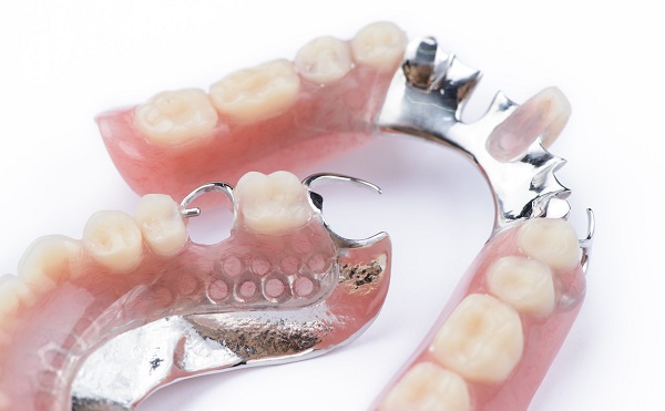 深圳愛康健牙科牙醫解析假牙能用多久？