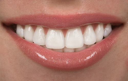 深圳愛康健牙科做全瓷貼面要多少錢?瓷貼面對牙齒有危害嗎