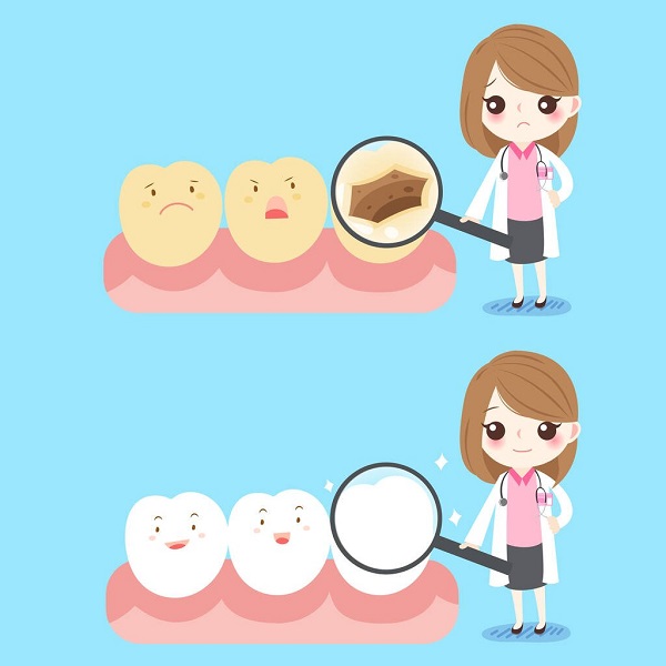 愛康健補牙價錢