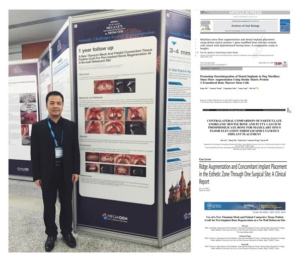 深圳種植牙醫生推薦劉鑫博士