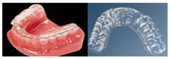 深圳軟性夜磨牙頜墊多少錢