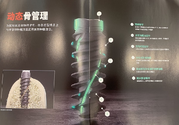 德國Ankylos種植牙多少錢