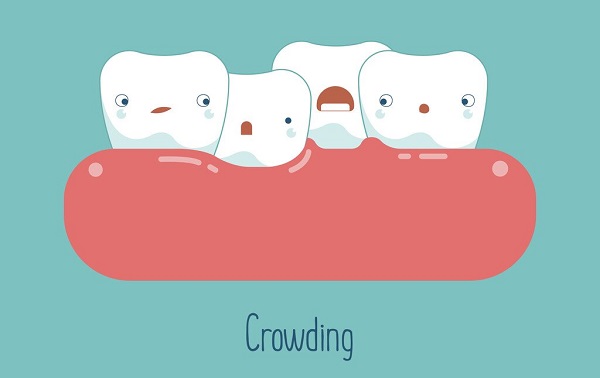 深圳牙齒矯正多少錢